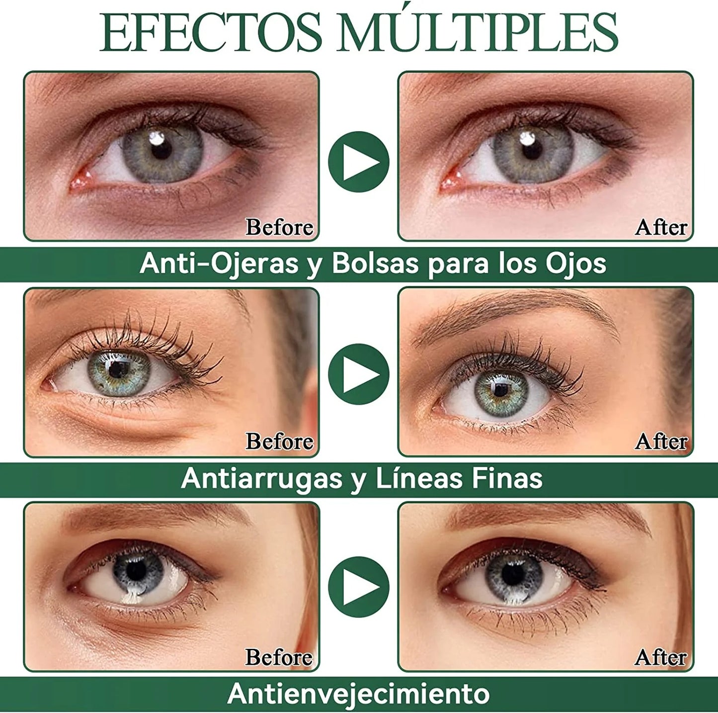 PARCHES REJUVENECEDORES DE OJOS ALOE VERA SKINCARE®️